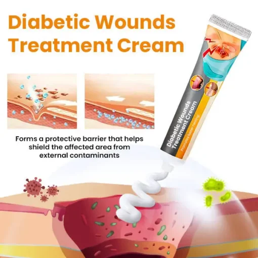 Histone™ Diabetic Wounds Treatment Cream