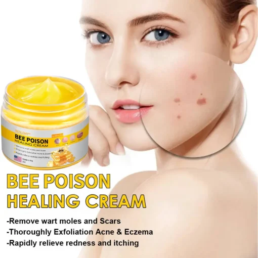 NESLEMY™ Bee Poison Skin Cream