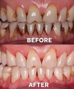 Ourlyard™ Teeth Restoration Mineral Powder