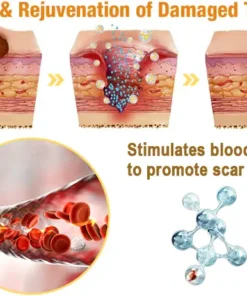 flysmus™ Lidocaine Scar-Free Pain Relief Healing Liquid