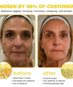 𝐅𝐮𝐛𝐬𝐭𝐚® 7-Day Botox Bee Venom Wrinkle Removal Cream