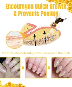 Ceoerty™ FungiGone Bee Venom Nail Cream