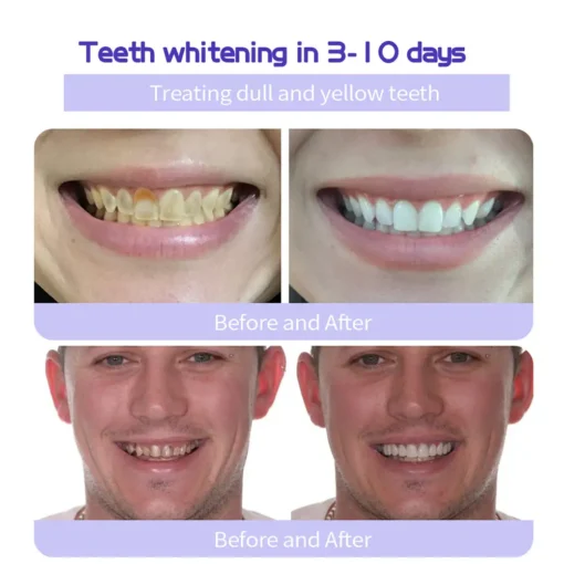 Cvreoz® Teeth Restoration Mineral Powder