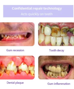 Cvreoz® Teeth Restoration Mineral Powder