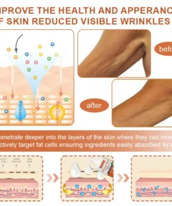 Flysmus™ BotoxBee Wrinkle Removal Cream