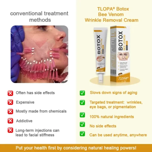 TLOPA®Botox Bee Venom Wrinkle Removal Cream