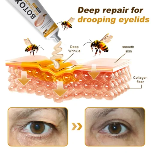 TLOPA®Botox Bee Venom Wrinkle Removal Cream