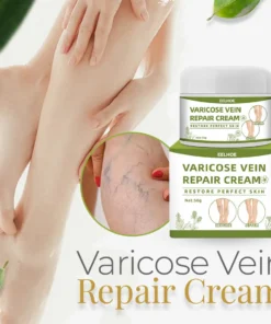 Varicose™ Vein Repair Cream (Point AAD Recommended) for Varicose Vein Removal, Spider Veins