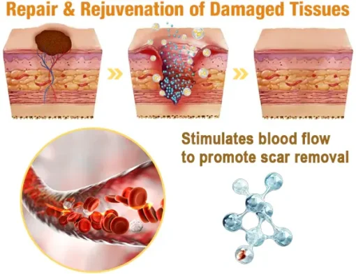 flysmus™ Lidocaine Scar-Free 5Mins Pain Relief Healing Spray